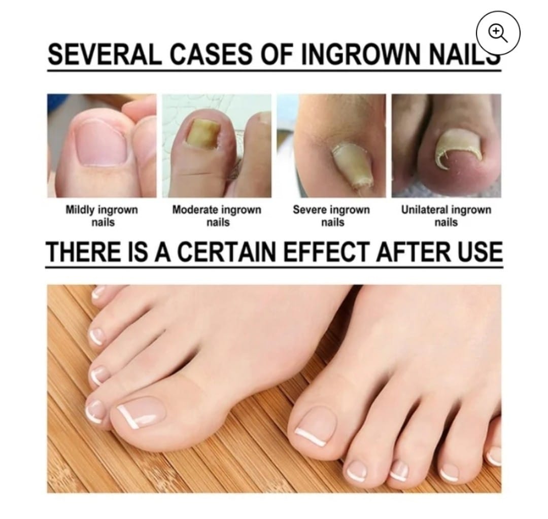 ACEITE REPARADOR DE UÑAS